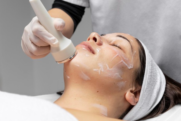 Chemical Peel-Off Technique For Acne Scar Removal